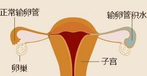 完全不需要正常怀孕时输卵管来发挥作用.