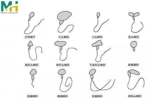 试管婴儿生儿子的机构