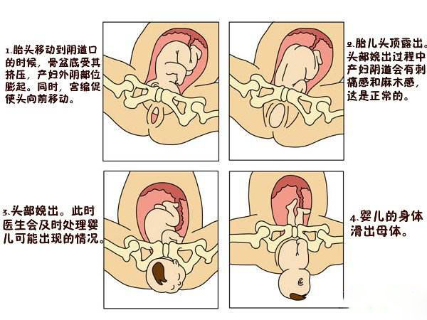 美国ccrh试管婴儿详解分娩过程的第二产程