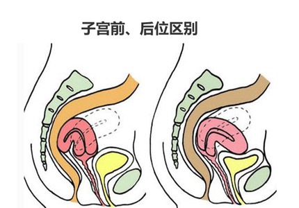 子宫前置有利于怀孕么?